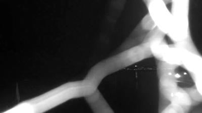 immagine della webcam nei dintorni di Civita Castellana: webcam Bracciano