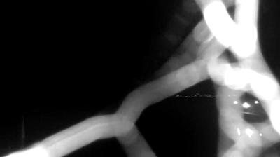 immagine della webcam nei dintorni di Trevignano Romano: webcam Bracciano