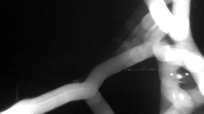 immagine della webcam nei dintorni di Marina di Cerveteri: webcam Bracciano