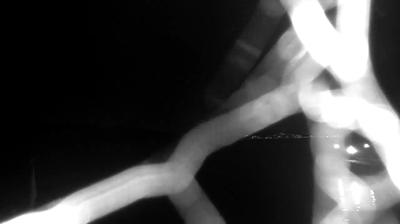 immagine della webcam nei dintorni di Civitavecchia: webcam Bracciano