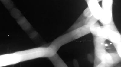 immagine della webcam nei dintorni di Cerveteri: webcam Bracciano